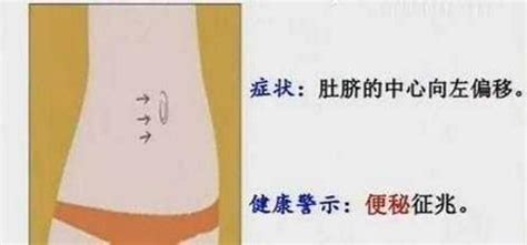 肚臍癢意思